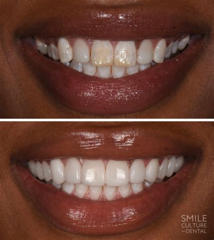 smile:&nbsp;bright&nbsp;on, $49